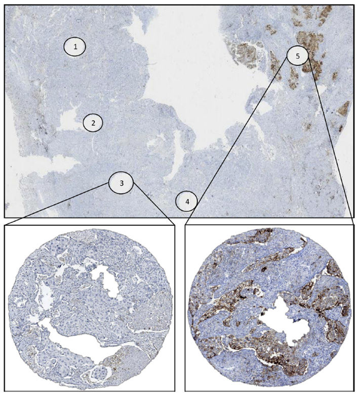 Circulogene-Pulmonary-Brochure-25.03-2.jpeg