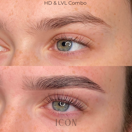 HD & LVL Combo, two sides of eyes, before and after, Icon Inspire.