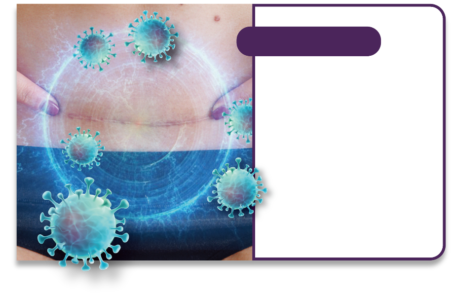 Prevena-20210728-WebSiteTheme_Box-B3_edited.png