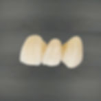 trueguide dental bruxzir