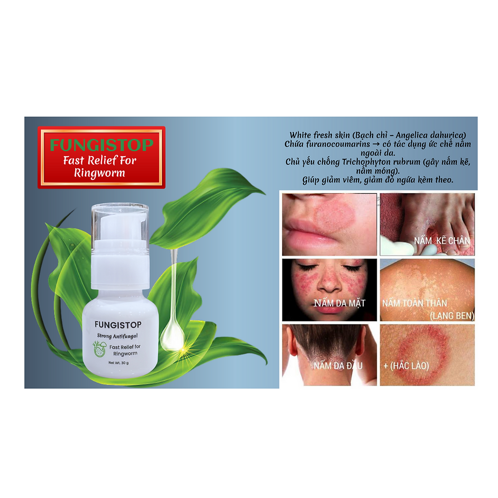 Thumbnail: Fast Relief for Ringworm Strong Antifungal-Net Wt. 30g
