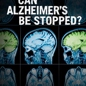 Can Alzheimer be Stopped?