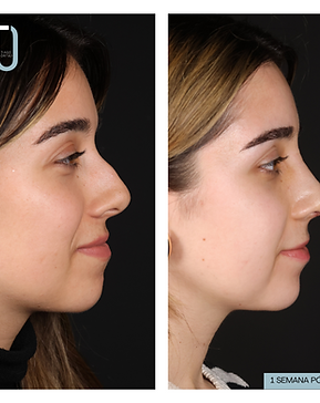 ANA SCARFONE (2).png