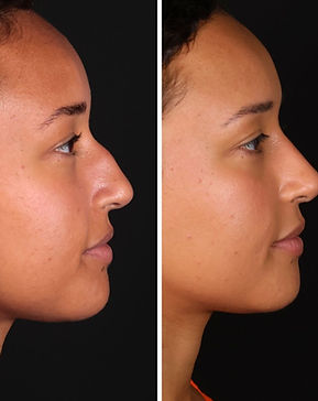 EMILY CHALA (2)_edited.jpg