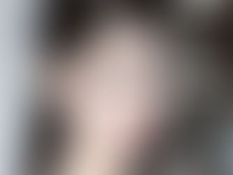 ปรับจมูกใหม่ให้ "หวานละมุน" รับใบหน้า สไตล์น้องเฟิร์น #นางฟ้าอ่าวไทย โดยอาจารย์จำรูญ