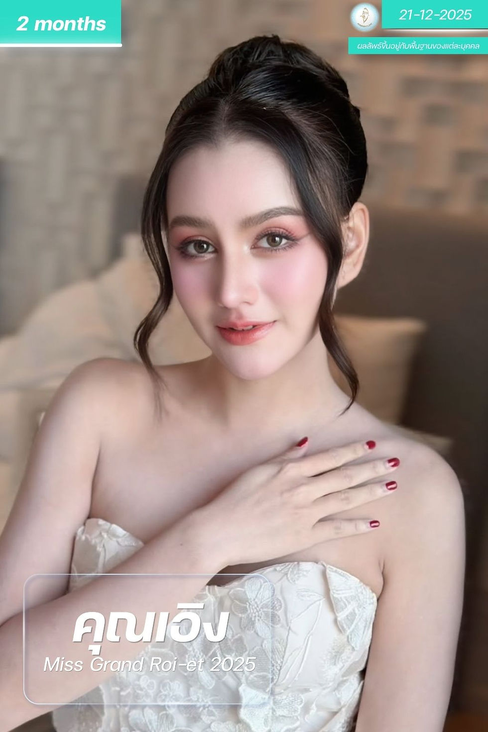 KAN (2)
