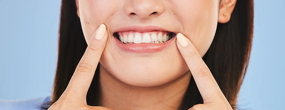 Best Vitamins for Healthy Gums