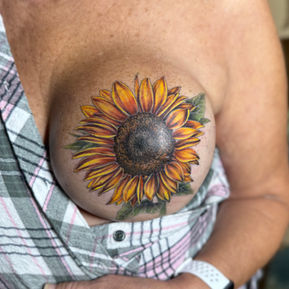 A breast from a mastectomy patient with a sunflower tattooed