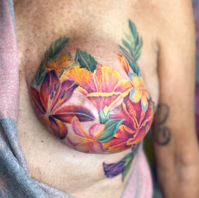 A mastectomy breast with a bouquet of flowers tattooed on over the scars