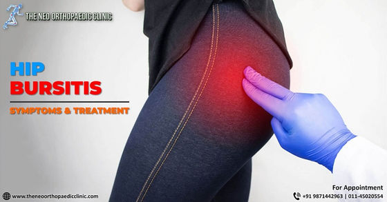 What are the symptoms of hip bursitis?