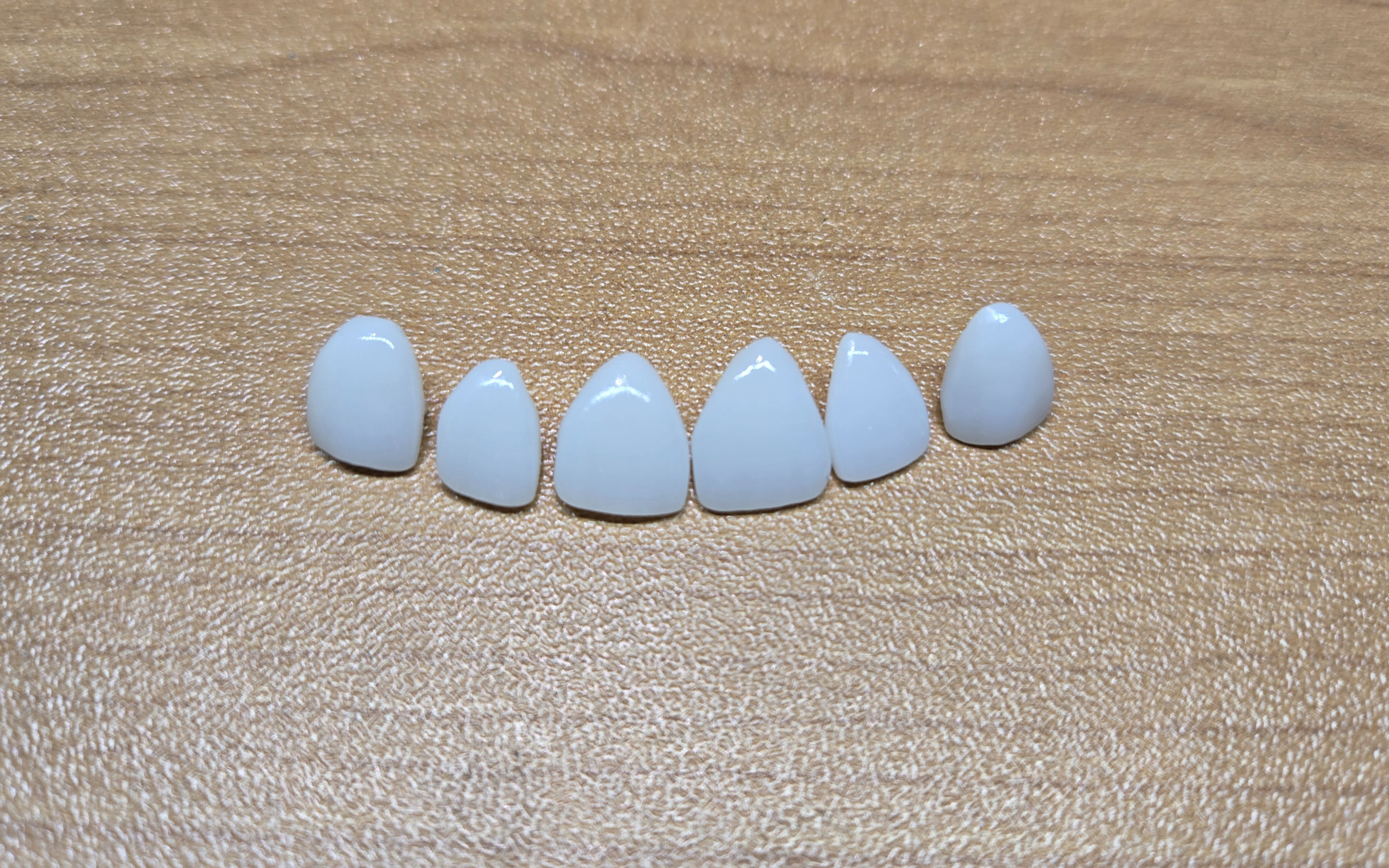 Veneers (Per Unit)