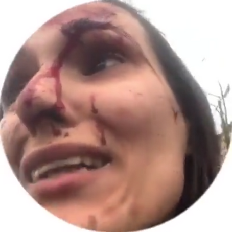 Ukrainian woman injured after apartment hit by Russian military shell - VIDEO