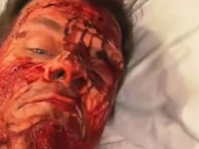 Heartbreaking Details: Perez Hilton Livestream Prompts Police Response to Miami Home Over Self-Harm Concerns