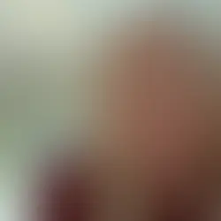  CHRISTINA APPLEGATE HOSPITALIZED