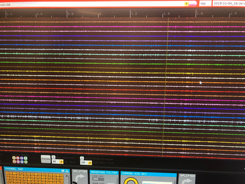 High channel-count electrophysiology