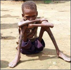 Starving child