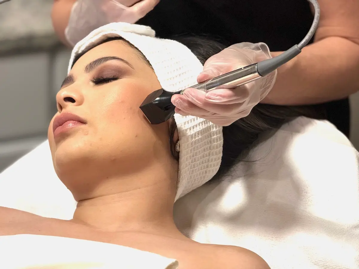 RF Skin Tightening | The Spa By Sheena