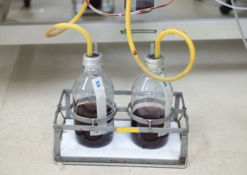 Cuidados de Enfermagem com o Dreno Torácico: Segurança e Eficiência na Assistência