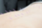 0783 Pono Accupuncture- 179