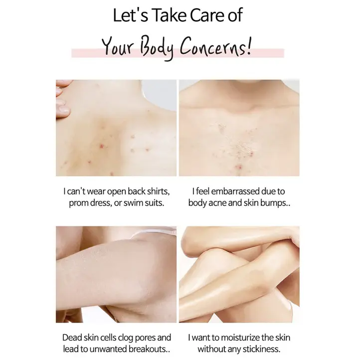 Thumbnail: TIAM Anti-Blemish Body Lotion (200ml)