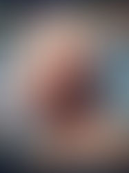 Protecting Brain Health After Menopause