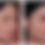 Thumbnail: Tretinoin Cream Acnelyse 0.1% X 3 Packs