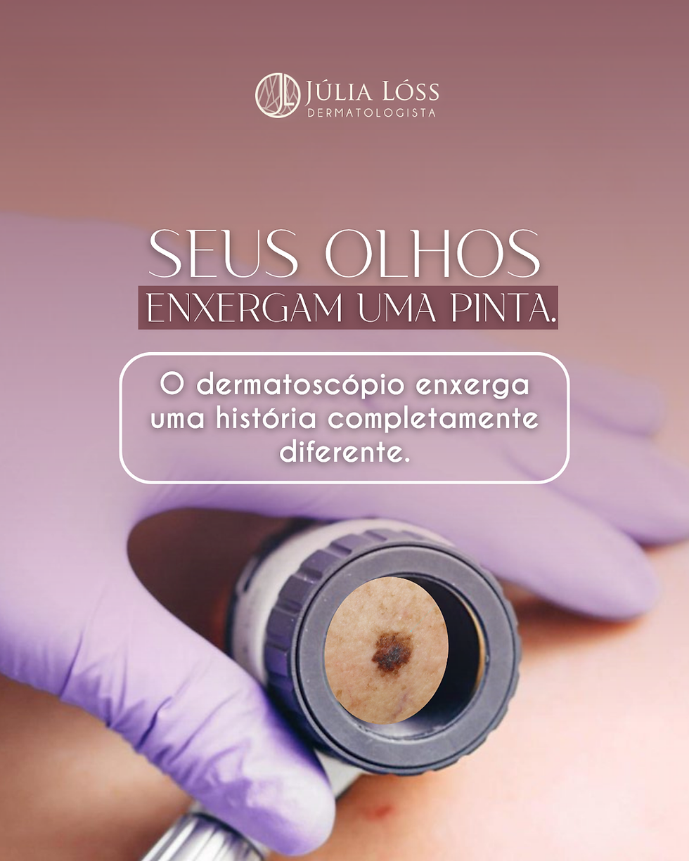 Seus olhos enxergam uma pinta