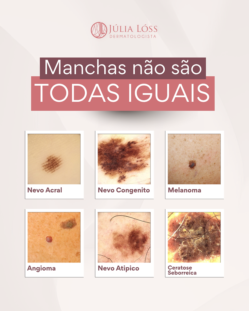 Nem todas as lesões de pele é igual mesmo quando parecem muito parecidas.