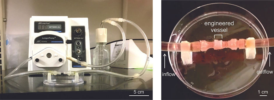 Small_TEV_Perfusion_Croped_with_text_2.j