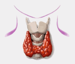 poti4629488cbf488.gif