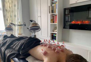 Who said that acupuncture has to involve needles?