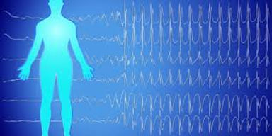 frequency.jpeg