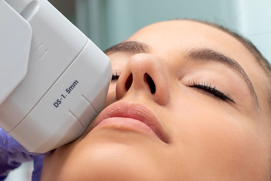Extreme close up of HIFU treatment on fe