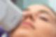 Extreme close up of HIFU treatment on fe
