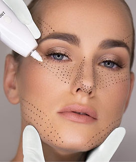 plasma lift, soin plasma paris, plasma pen, plasma lift paris, plasmalift, lifting paupieres paris, plasma lifting, plasma prix, fibroblast paris, plexr, plasma paris, anti rides paris, vergetures paris, fibroblast plasma, plaxel, plasma shower, traitement plasma, plaxel plus paris, cold plasma, plasma, lifting plasma, plasma jett