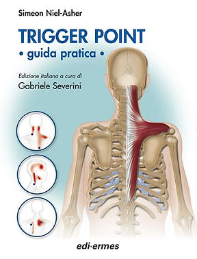 Trigger Point