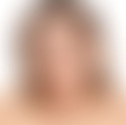 Desde la nicotina a la vigorexia: cómo los malos hábitos afectan a la piel