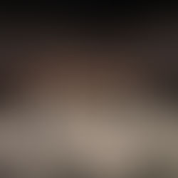 La Raíz apaga La Hoguera de los Continentes con la grabación de un disco en directo