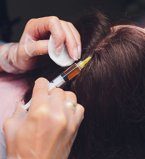 PRP for Face & Hair
