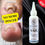 Thumbnail: Restore a Nail