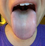 Tongue Picture 1