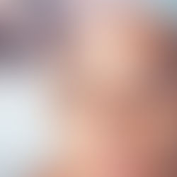 Microneedling is safe and effective for most skin types and tones. It’s particularly ideal for clients experiencing: Premature aging Acne scarring Pigmentation or sun damage Dehydrated, dull skin Uneven tone or texture It can also be combined with other treatments for compounded results—something we specialize in designing for each individual.