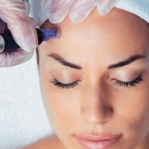 Microneedling is safe and effective for most skin types and tones. It’s particularly ideal for clients experiencing: Premature aging Acne scarring Pigmentation or sun damage Dehydrated, dull skin Uneven tone or texture It can also be combined with other treatments for compounded results—something we specialize in designing for each individual.