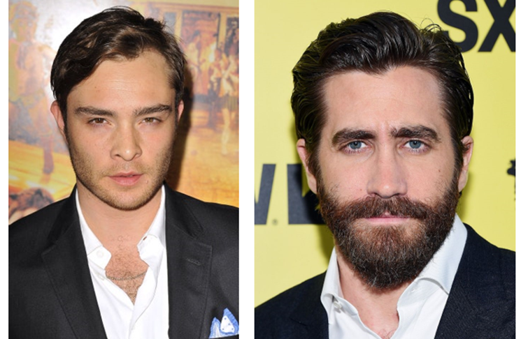 Europe’s Leading Hair Transplant Clinic Predict Beard Trends for 2024