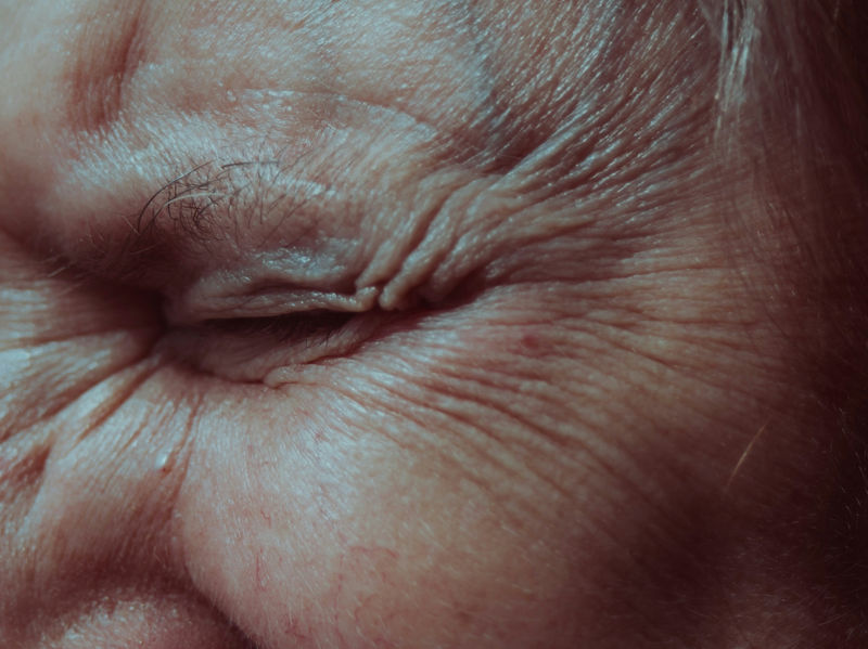 How Do Anti-Wrinkle Injections Work?