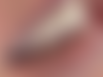 Şiddetli Diş Ağrısı Sorunlarında Ne Yapılmalı? Bursa diş hekimi