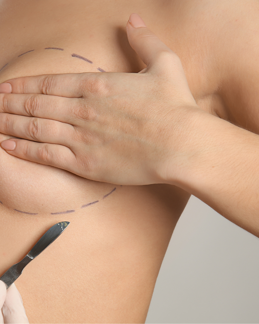 Fast Recovery in Breast Augmentation