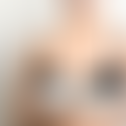 Natural-Looking Breast Enhancement: Subtle, Feminine Results with Modern Aesthetic Techniques