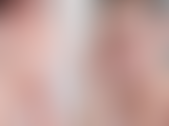 Diş Sağlığını Korumak İçin Hangi Besinlerden Kaçınmalıyız? Bursa diş klinik