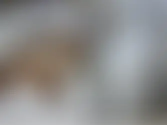 ՀՀ ՊՆ-ն՝ վիրավորում ստացած պայմանագրային զինծառայողի վիճակի մասին